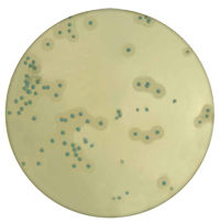 Listeria monocytogenes Chromogenic Media